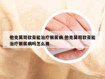 他克莫司软膏能治疗银屑病 他克莫司软膏能治疗银屑病吗怎么用