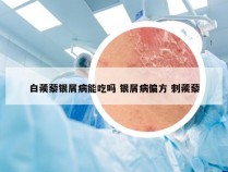 白蒺藜银屑病能吃吗 银屑病偏方 刺蒺藜