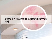 小孩可不可打生物制剂 生物制剂未成年可以打吗