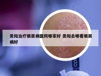 贵阳治疗银屑病医院哪家好 贵阳去哪看银屑病好