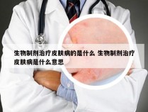 生物制剂治疗皮肤病的是什么 生物制剂治疗皮肤病是什么意思