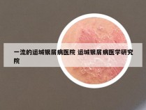 一流的运城银屑病医院 运城银屑病医学研究院