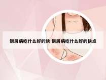 银屑病吃什么好的快 银屑病吃什么好的快点