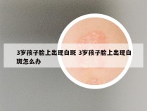 3岁孩子脸上出现白斑 3岁孩子脸上出现白斑怎么办