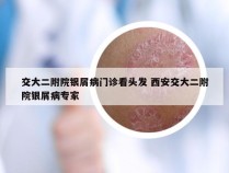 交大二附院银屑病门诊看头发 西安交大二附院银屑病专家