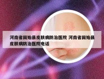 河南省固始县皮肤病防治医院 河南省固始县皮肤病防治医院电话