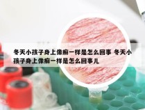 冬天小孩子身上像癣一样是怎么回事 冬天小孩子身上像癣一样是怎么回事儿