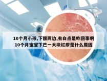 10个月小孩,下额两边,有白点是咋回事啊 10个月宝宝下巴一大块红疹是什么原因