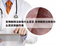 生物制剂注射有什么禁忌 生物制剂注射有什么禁忌和副作用