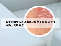 五十岁的女人身上出现了白色小斑点 五十多岁身上出现白点