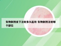 生物制剂皮下注射多久起效 生物制剂注射哪个部位