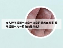 女人脖子后面一块白一块白的是怎么回事 脖子后面一片一片白的是什么?