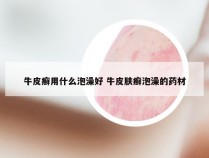 牛皮癣用什么泡澡好 牛皮肤癣泡澡的药材