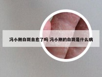 冯小刚白斑自愈了吗 冯小刚的白斑是什么病