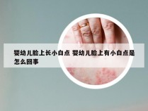 婴幼儿脸上长小白点 婴幼儿脸上有小白点是怎么回事