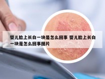 婴儿脸上长白一块是怎么回事 婴儿脸上长白一块是怎么回事图片