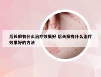 后长癣有什么治疗效果好 后长癣有什么治疗效果好的方法