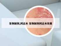 生物制剂,阿达木 生物制剂阿达木效果