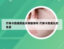 疗癣卡西甫散能长期服用吗 疗癣卡西甫丸的危害