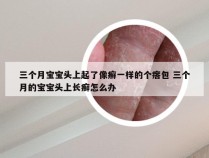 三个月宝宝头上起了像癣一样的个瘩包 三个月的宝宝头上长癣怎么办