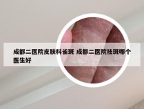 成都二医院皮肤科雀斑 成都二医院祛斑哪个医生好