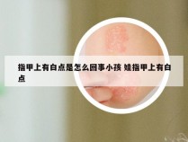 指甲上有白点是怎么回事小孩 娃指甲上有白点