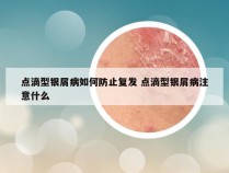 点滴型银屑病如何防止复发 点滴型银屑病注意什么