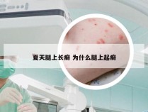 夏天腿上长癣 为什么腿上起癣