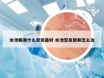 水泡癣用什么软膏最好 水泡型皮肤癣怎么治