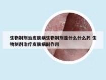 生物制剂治皮肤病生物制剂是什么什么药 生物制剂治疗皮肤病副作用