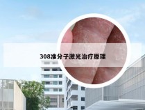 308准分子激光治疗原理