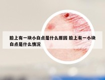 脸上有一块小白点是什么原因 脸上有一小块白点是什么情况