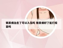 银屑病治愈了可以入伍吗 银屑病好了能打疫苗吗