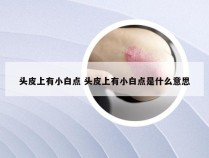 头皮上有小白点 头皮上有小白点是什么意思