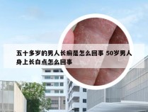 五十多岁的男人长癣是怎么回事 50岁男人身上长白点怎么回事