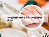 301医院看牛皮癣怎么样 301医院银屑病专科