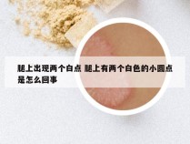 腿上出现两个白点 腿上有两个白色的小圆点是怎么回事