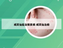 威灵仙能治银屑病 威灵仙治癣