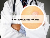 白癜风能不能打新冠肺炎疫苗