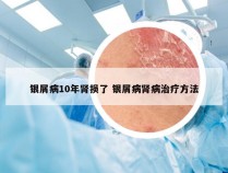 银屑病10年肾损了 银屑病肾病治疗方法