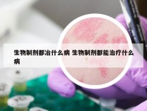 生物制剂都冶什么病 生物制剂都能治疗什么病