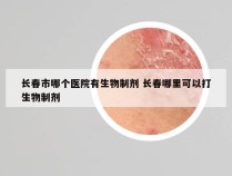 长春市哪个医院有生物制剂 长春哪里可以打生物制剂