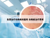 免费治疗白殿疯的医院 白殿疯治疗费用