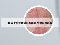 医学上的生物制剂有哪些 生物制剂都有