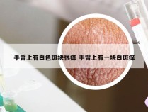 手臂上有白色斑块很痒 手臂上有一块白斑痒