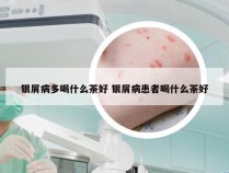 银屑病多喝什么茶好 银屑病患者喝什么茶好