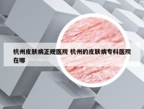 杭州皮肤病正规医院 杭州的皮肤病专科医院在哪