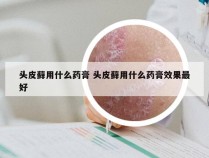 头皮藓用什么药膏 头皮藓用什么药膏效果最好