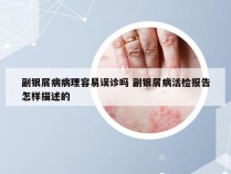 副银屑病病理容易误诊吗 副银屑病活检报告怎样描述的