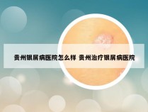 贵州银屑病医院怎么样 贵州治疗银屑病医院